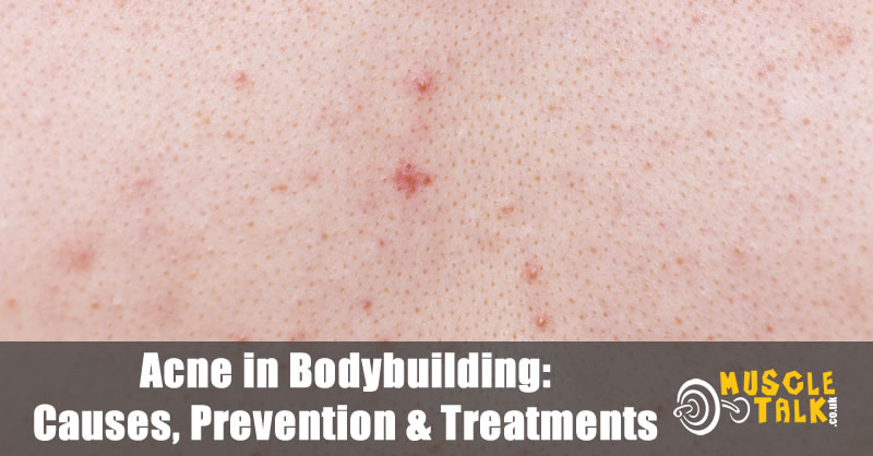 Acne in Bodybuilding