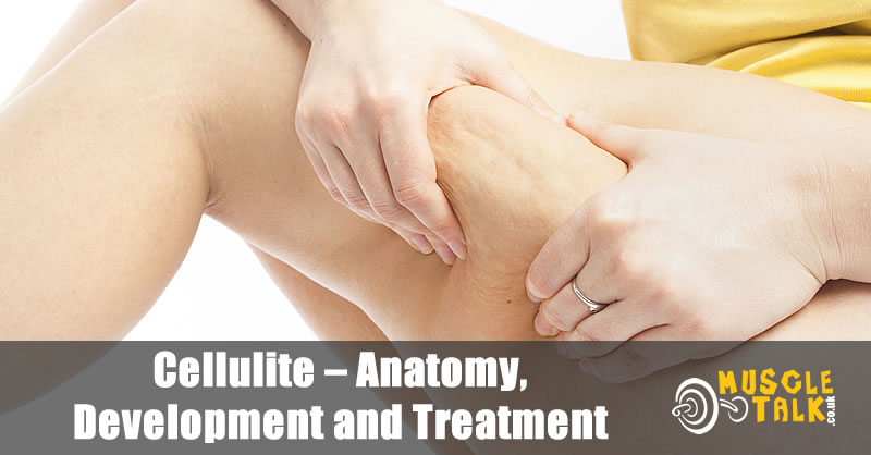 Cellulite - Anatomy, Development and Treatment